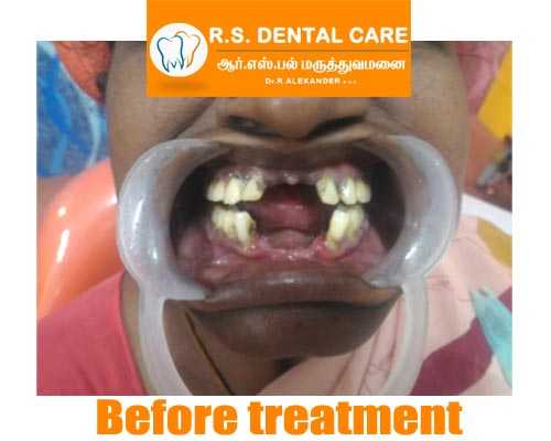 Leading Dental Surgery Chinnamanur
