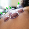 Theni District Hijama Therapy