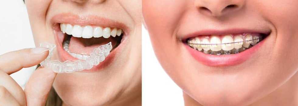 Smart Clips Dental Clinic