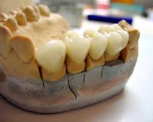 Affordable Dental Lab Batlagundu