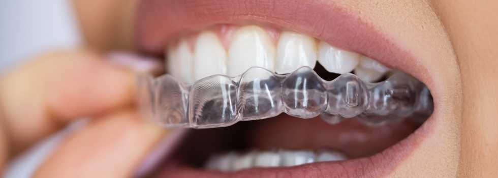 Smart Clips Dental Clinic