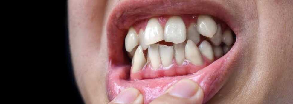 Smart Clips Dental Clinic