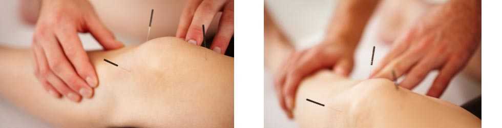 Acupuncture Clinic Chinnamanur