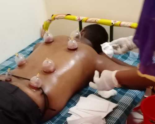 Cupping Therapy Weight Loss Treatment Andipatti