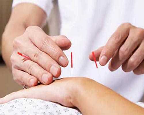 Acupuncture Diabetics Treatment Chinnamanur
