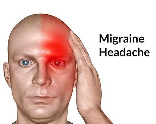 Ayurveda Migraine Cure Dindigul