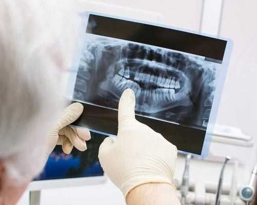 Dental X-Rays Chinnamanur Cumbum